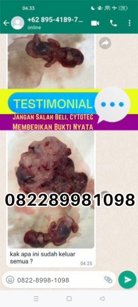 obat-penggugur-kandungan-12-minggu